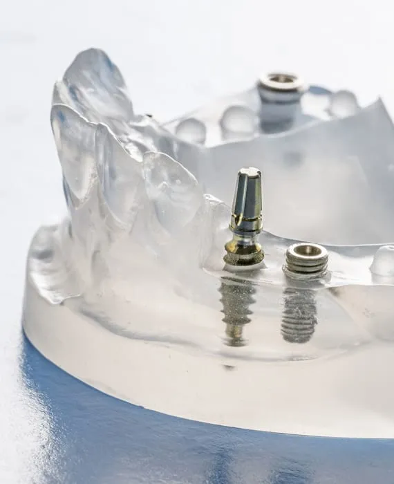 Implantologie Melchior & Hilbert Zahnärzte Remscheid