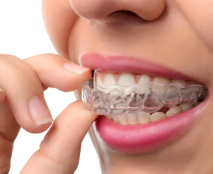 Schienentherapie Melchior & Hilbert Zahnärzte Remscheid