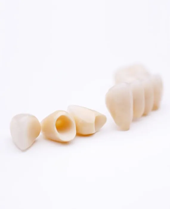 Vollkeramik Melchior & Hilbert Zahnärzte Remscheid